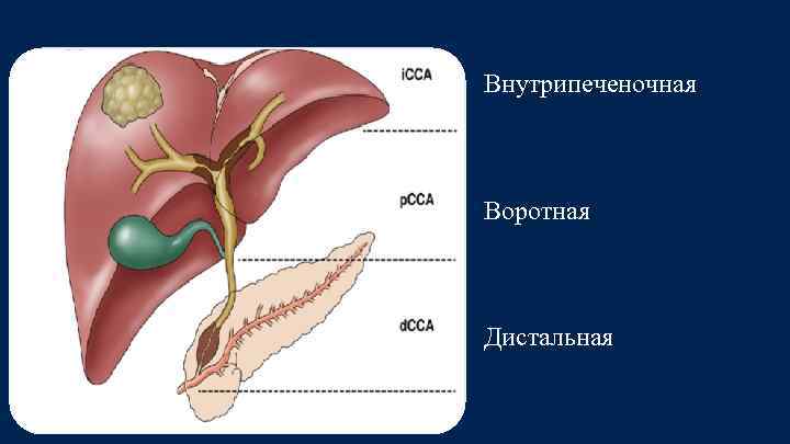 Внутрипеченочная Воротная Дистальная 