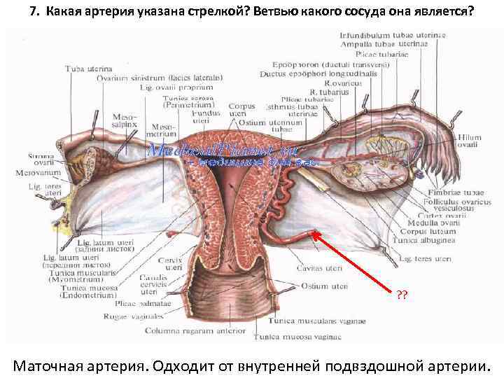7. Какая артерия указана стрелкой? Ветвью какого сосуда она является? ? ? Маточная артерия.