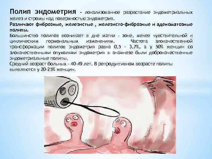 Полип эндометрия – локализованное разрастание эндометриальных желез и стромы над поверхностью эндометрия. Различают фиброзные,