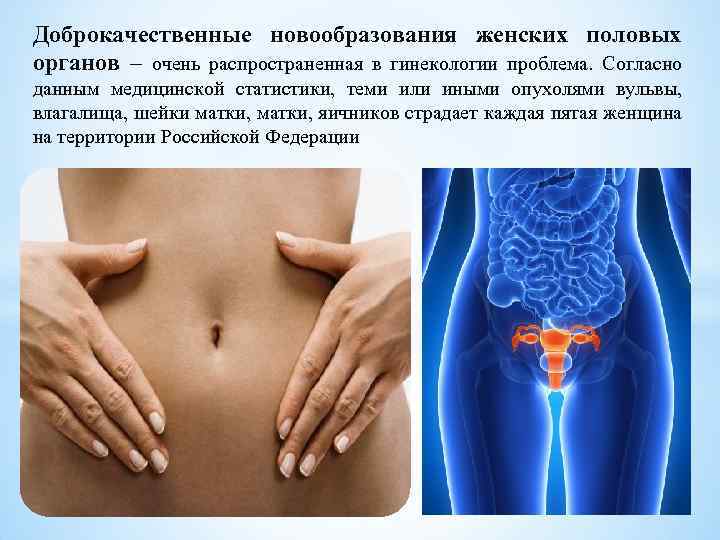 Доброкачественные новообразования женских половых органов – очень распространенная в гинекологии проблема. Согласно данным медицинской