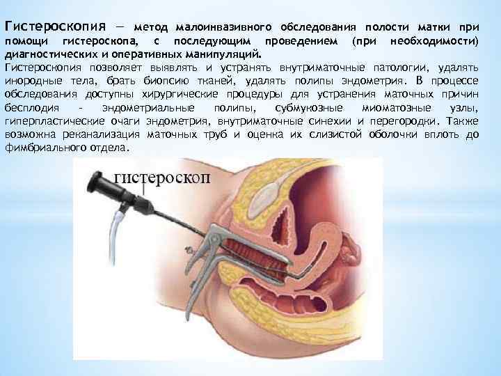 Гистероскопия — метод малоинвазивного обследования полости матки при помощи гистероскопа, с последующим проведением (при