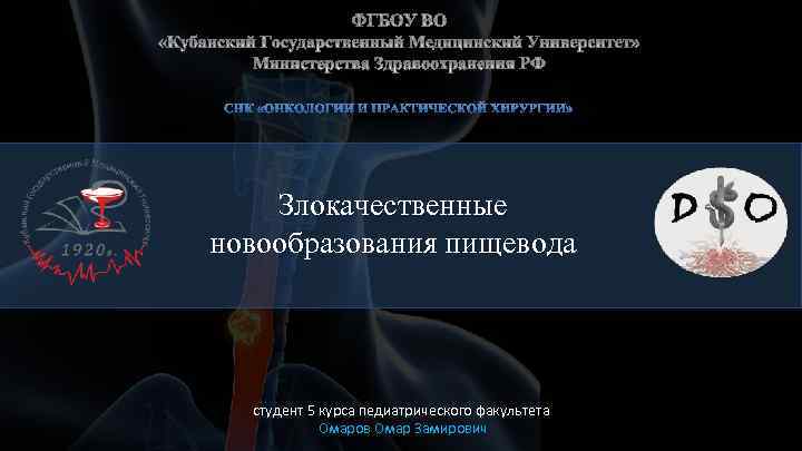Злокачественные новообразования пищевода студент 5 курса педиатрического факультета Омаров Омар Замирович 