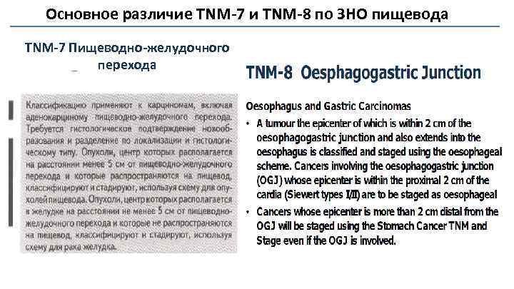 Основное различие TNM-7 и TNM-8 по ЗНО пищевода TNM-7 Пищеводно-желудочного перехода 