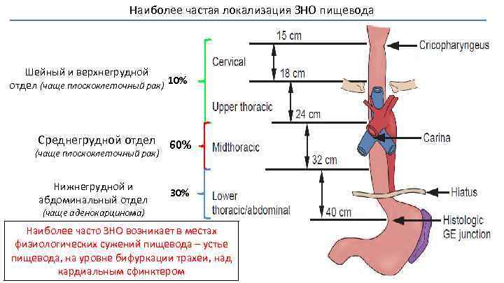 Наиболее частая локализация ЗНО пищевода Шейный и верхнегрудной отдел (чаще плоскоклеточный рак) 10% Среднегрудной