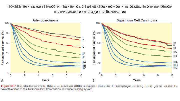 Показатели выживаемости пациентов с аденокарциномой и плоскоклеточным раком в зависимости от стадии заболевания 