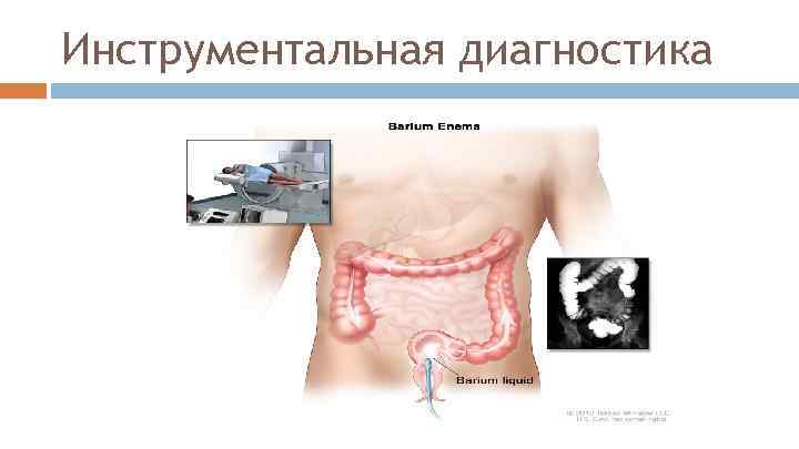 Инструментальная диагностика 