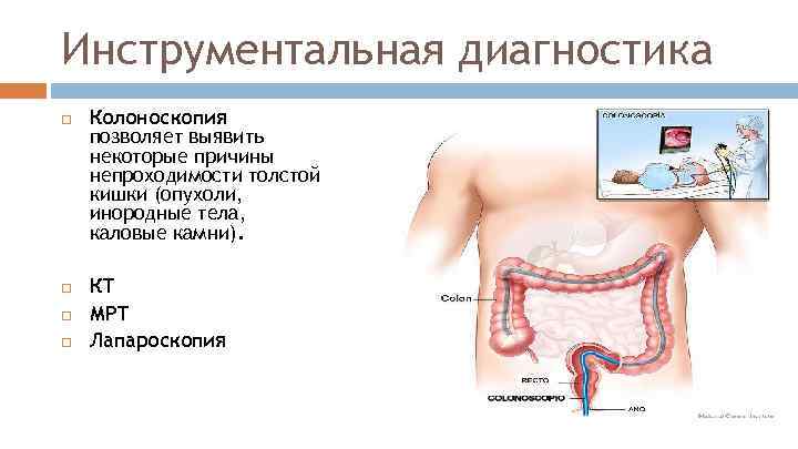 Инструментальная диагностика Колоноскопия позволяет выявить некоторые причины непроходимости толстой кишки (опухоли, инородные тела, каловые