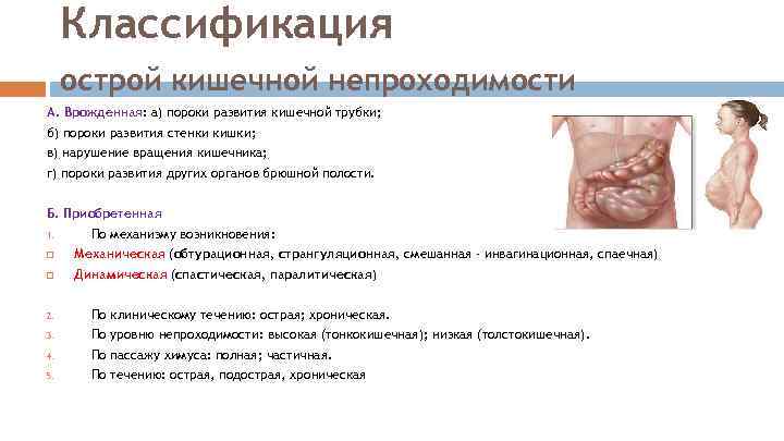 Классификация острой кишечной непроходимости А. Врожденная: а) пороки развития кишечной трубки; б) пороки развития