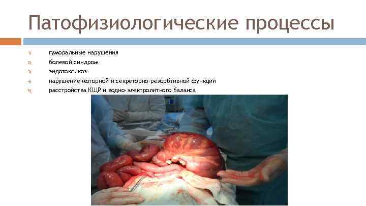 Патофизиологические процессы 1) гуморальные нарушения 2) болевой синдром 3) эндотоксикоз 4) нарушение моторной и