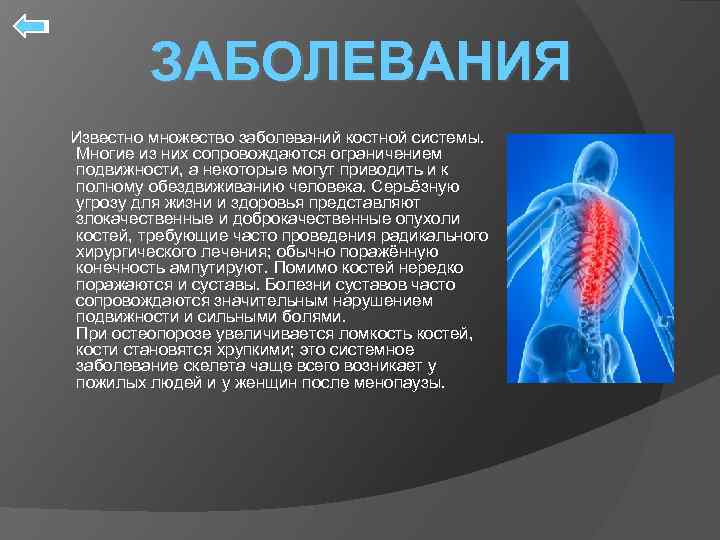 ЗАБОЛЕВАНИЯ Известно множество заболеваний костной системы. Многие из них сопровождаются ограничением подвижности, а некоторые