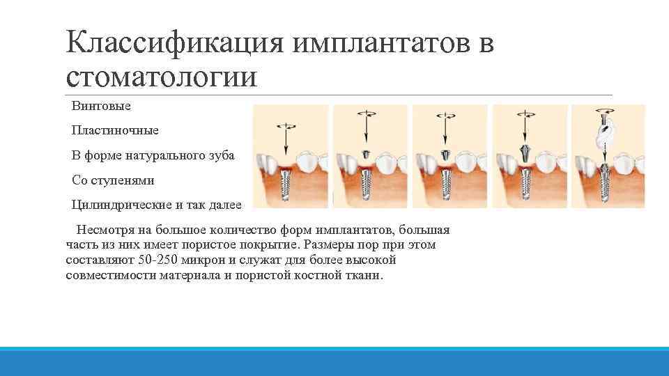 Анатомические предпосылки стоматологической имплантации презентация