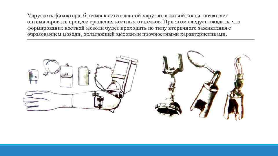 Упругость фиксатора, близкая к естественной упругости живой кости, позволяет оптимизировать процесс сращения костных отломков.