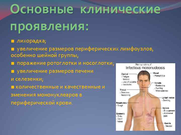 Мононуклеоз у детей картинки