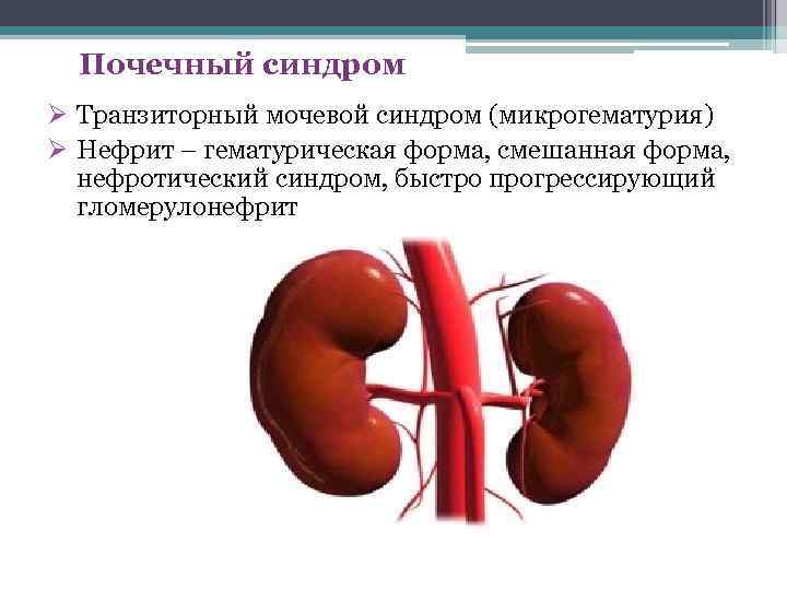 Почечный синдром Ø Транзиторный мочевой синдром (микрогематурия) Ø Нефрит – гематурическая форма, смешанная форма,