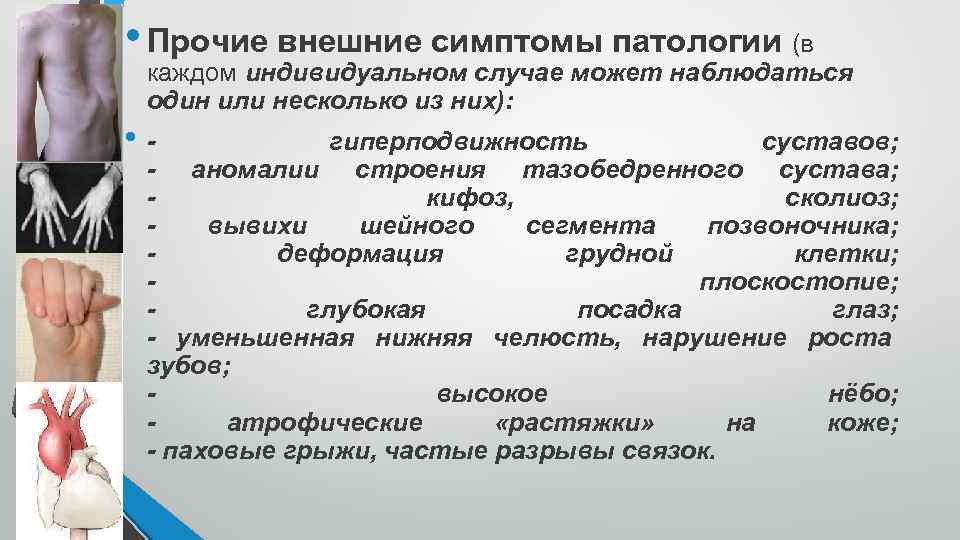  • Прочие внешние симптомы патологии (в каждом индивидуальном случае может наблюдаться один или