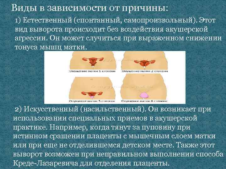 Виды в зависимости от причины: 1) Естественный (спонтанный, самопроизвольный). Этот вид выворота происходит без