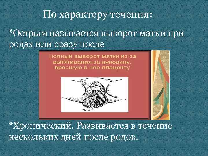 По характеру течения: *Острым называется выворот матки при родах или сразу после *Хронический. Развивается