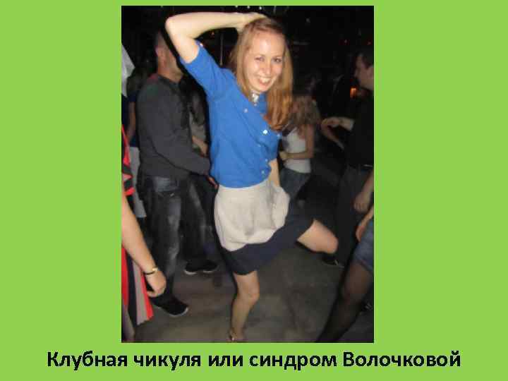 Клубная чикуля или синдром Волочковой 