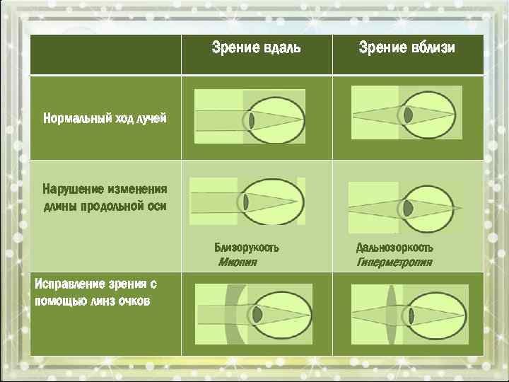 Зрение вдаль Зрение вблизи Близорукость Дальнозоркость Миопия Гиперметропия Нормальный ход лучей Нарушение изменения длины