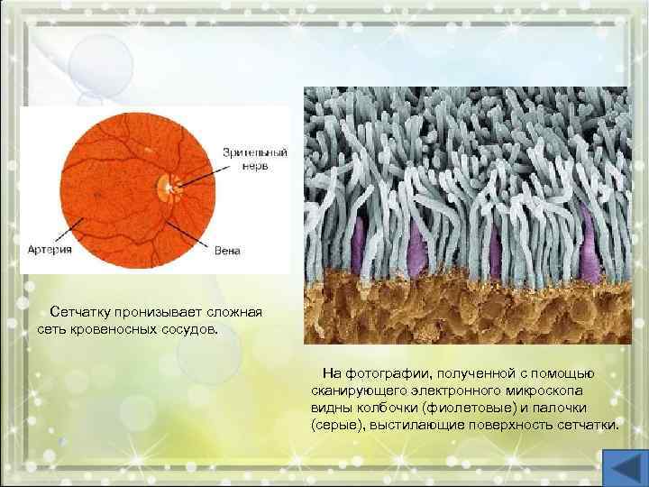 Сетчатку пронизывает сложная сеть кровеносных сосудов. На фотографии, полученной с помощью сканирующего электронного микроскопа