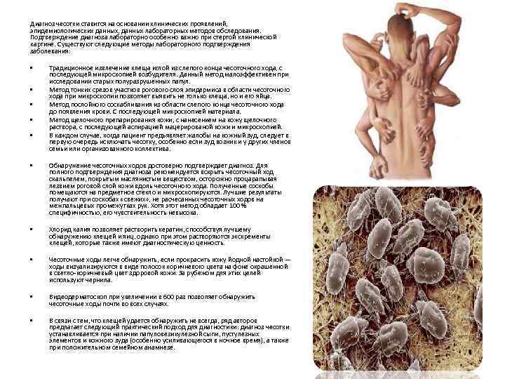 Диагноз чесотки ставится на основании клинических проявлений, эпидемиологических данных, данных лабораторных методов обследования. Подтверждение