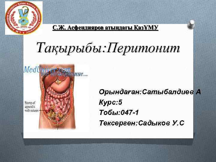 Тақырыбы: Перитонит Орындаған: Сатыбалдиев А Курс: 5 Тобы: 047 -1 Тексерген: Садыков У. С