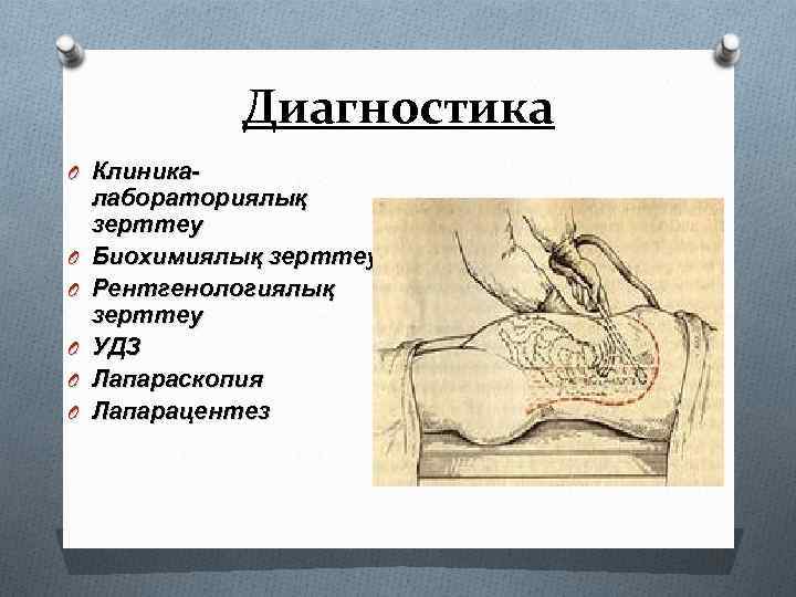 Диагностика O Клиника- O O O лабораториялық зерттеу Биохимиялық зерттеу Рентгенологиялық зерттеу УДЗ Лапараскопия