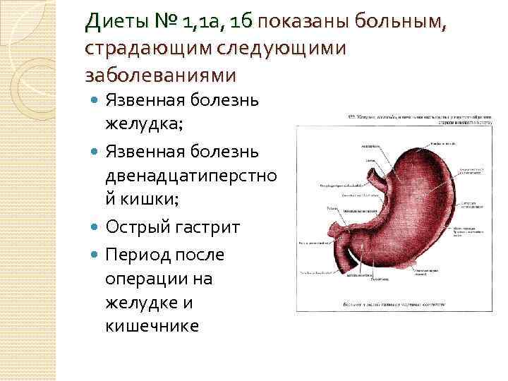 Диеты № 1, 1 а, 1 б показаны больным, страдающим следующими заболеваниями Язвенная болезнь