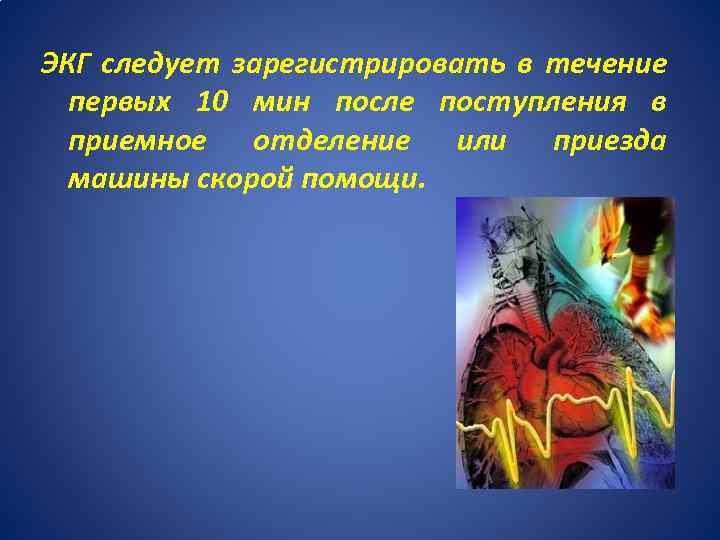 ЭКГ следует зарегистрировать в течение первых 10 мин после поступления в приемное отделение или
