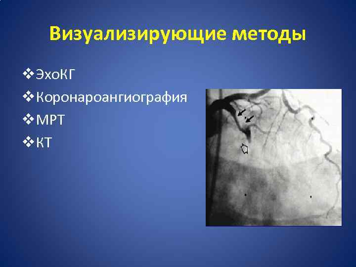 Визуализирующие методы v. Эхо. КГ v. Коронароангиография v. МРТ v. КТ 