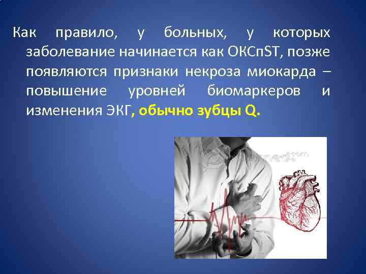 Как правило, у больных, у которых заболевание начинается как ОКСп. ST, позже появляются признаки