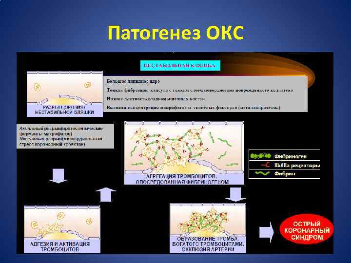 Патогенез ОКС 