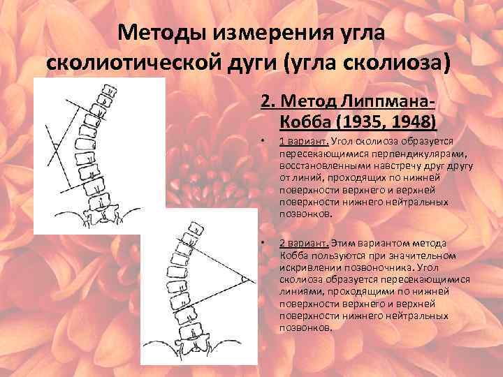 Степени кифоза. Рентген сколиоз угол Кобба. Сколиоз 3 степени угол Кобба. Угол Кобба степени сколиоза. Метод Кобба сколиоз.