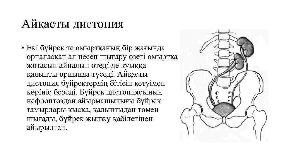 Айқасты дистопия • Екі бүйрек те омыртқаның бір жағында орналасқан ал несеп шығару өзегі