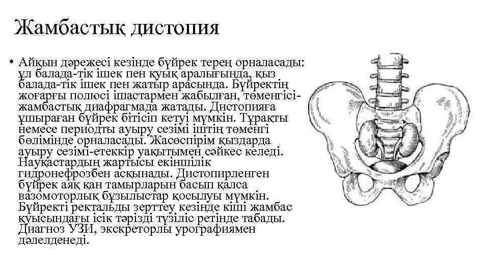 Жамбастық дистопия • Айқын дәрежесі кезінде бүйрек терең орналасады: ұл балада-тік ішек пен қуық