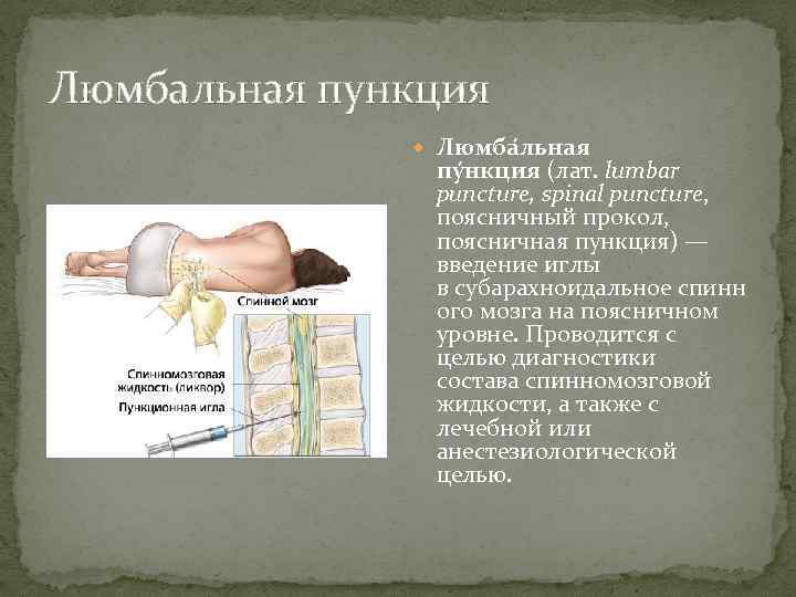 Люмбальная пункция Люмба льная пу нкция (лат. lumbar puncture, spinal puncture, поясничный прокол, поясничная