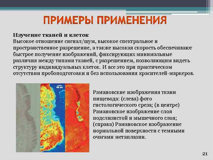 Изучение тканей и клеток Высокое отношение сигнал/шум, высокое спектральное и пространственное разрешение, а также