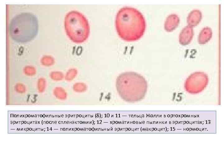 Полихроматофильные эритроциты (8); 10 и 11 — тельца Жолли в ортохромных эритроцитах (после спленэктомии);