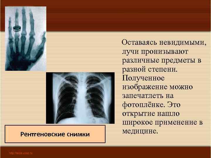 Рентгеновские снимки 03. 02. 2018 Оставаясь невидимыми, лучи пронизывают различные предметы в разной степени.