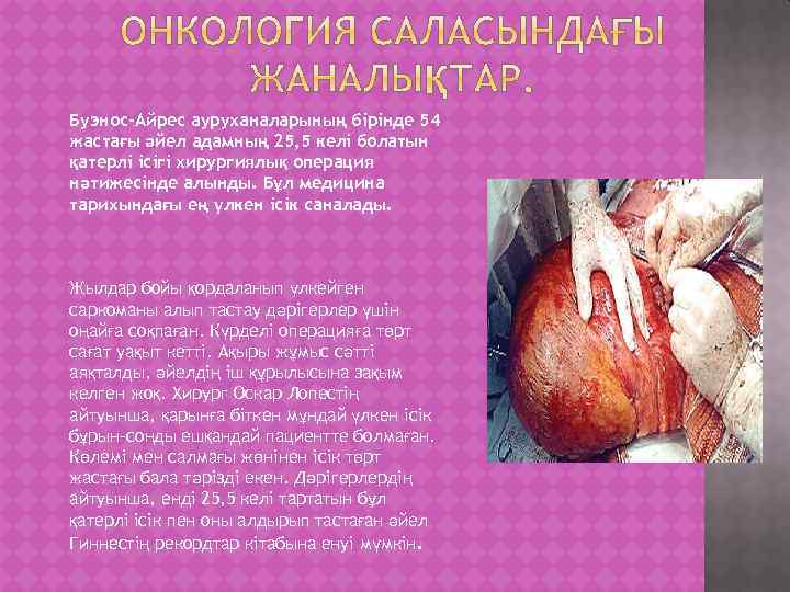 Буэнос-Айрес ауруханаларының бірінде 54 жастағы әйел адамның 25, 5 келі болатын қатерлі ісігі хирургиялық