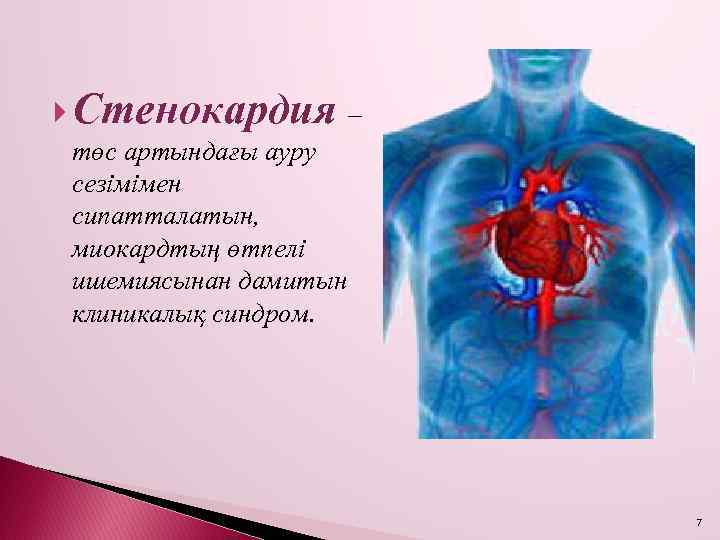  Стенокардия – төс артындағы ауру сезімімен сипатталатын, миокардтың өтпелі ишемиясынан дамитын клиникалық синдром.