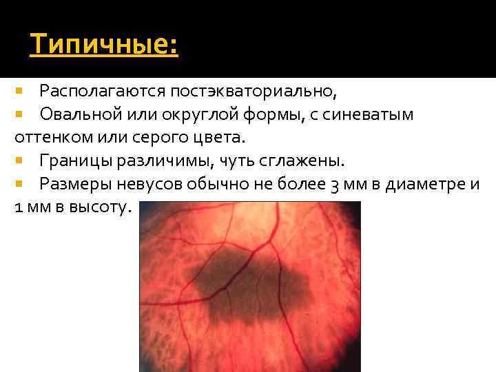 Типичные: Располагаются постэкваториально, Овальной или округлой формы, с синеватым оттенком или серого цвета. Границы