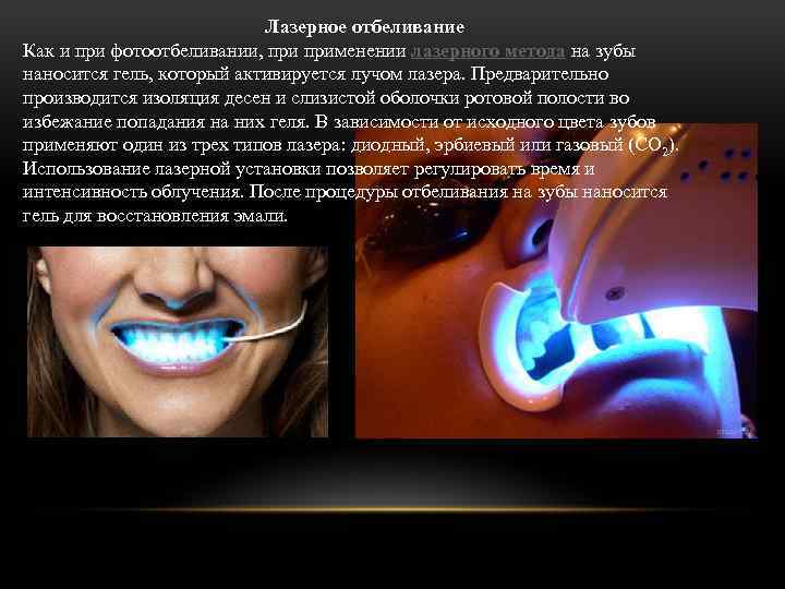 Лазерное отбеливание Как и при фотоотбеливании, применении лазерного метода на зубы наносится гель, который