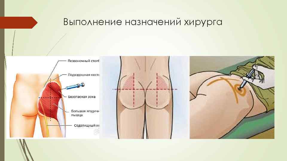 Выполнение назначений хирурга 