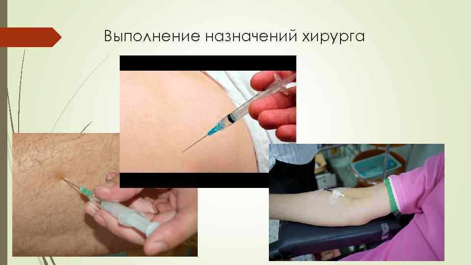 Выполнение назначений хирурга 