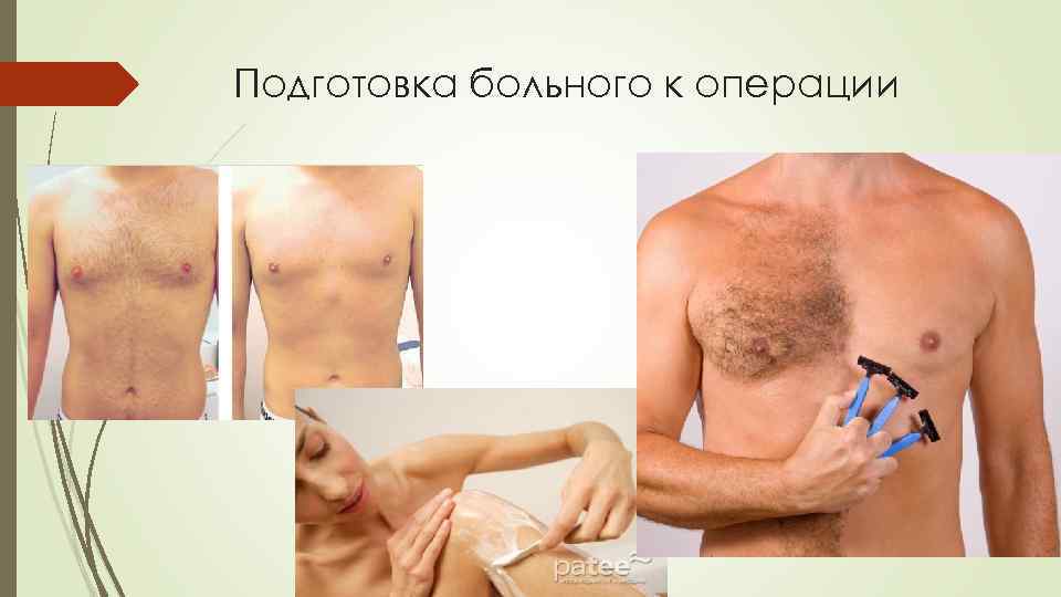 Подготовка больного к операции 