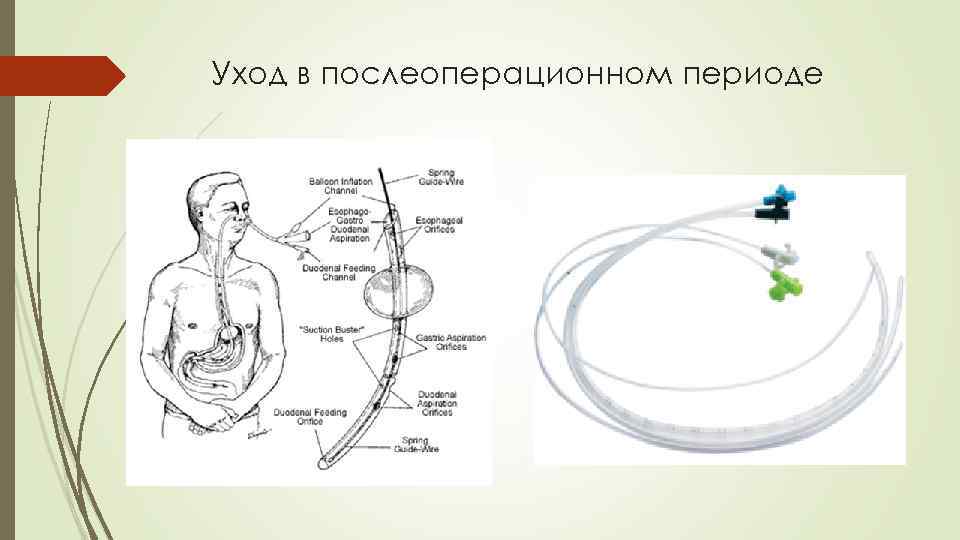 Уход в послеоперационном периоде 