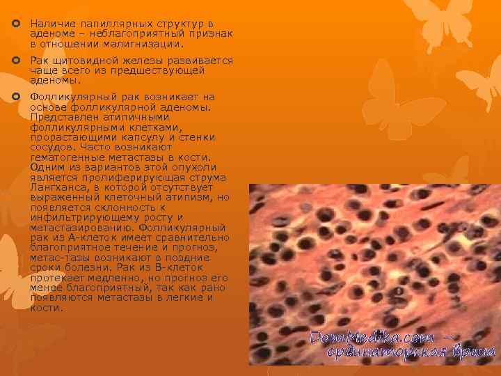  Наличие папиллярных структур в аденоме – неблагоприятный признак в отношении малигнизации. Рак щитовидной