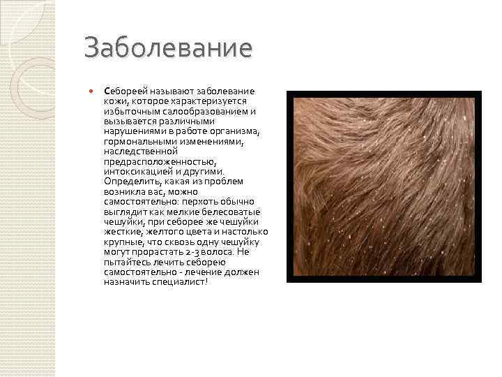 Заболевание Себореей называют заболевание кожи, которое характеризуется избыточным салообразованием и вызывается различными нарушениями в