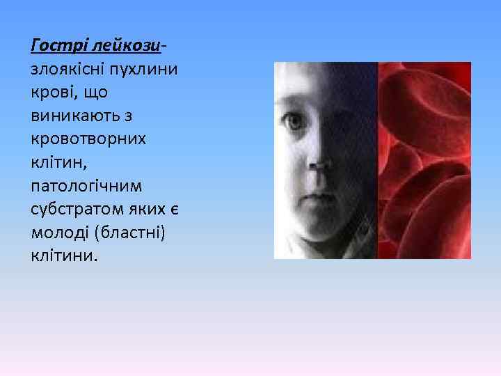 Гострі лейкозизлоякісні пухлини крові, що виникають з кровотворних клітин, патологічним субстратом яких є молоді